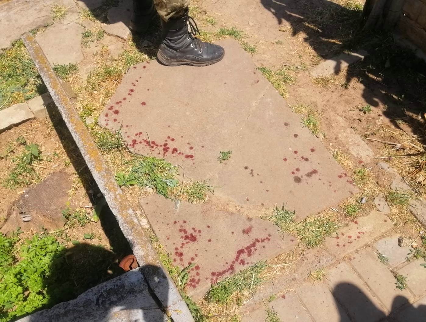 поліція документує наслідки обстрілів херсона та області: війська рф цілили у евакуаційні групи, поранено трьох поліцейських та неповнолітню дівчину