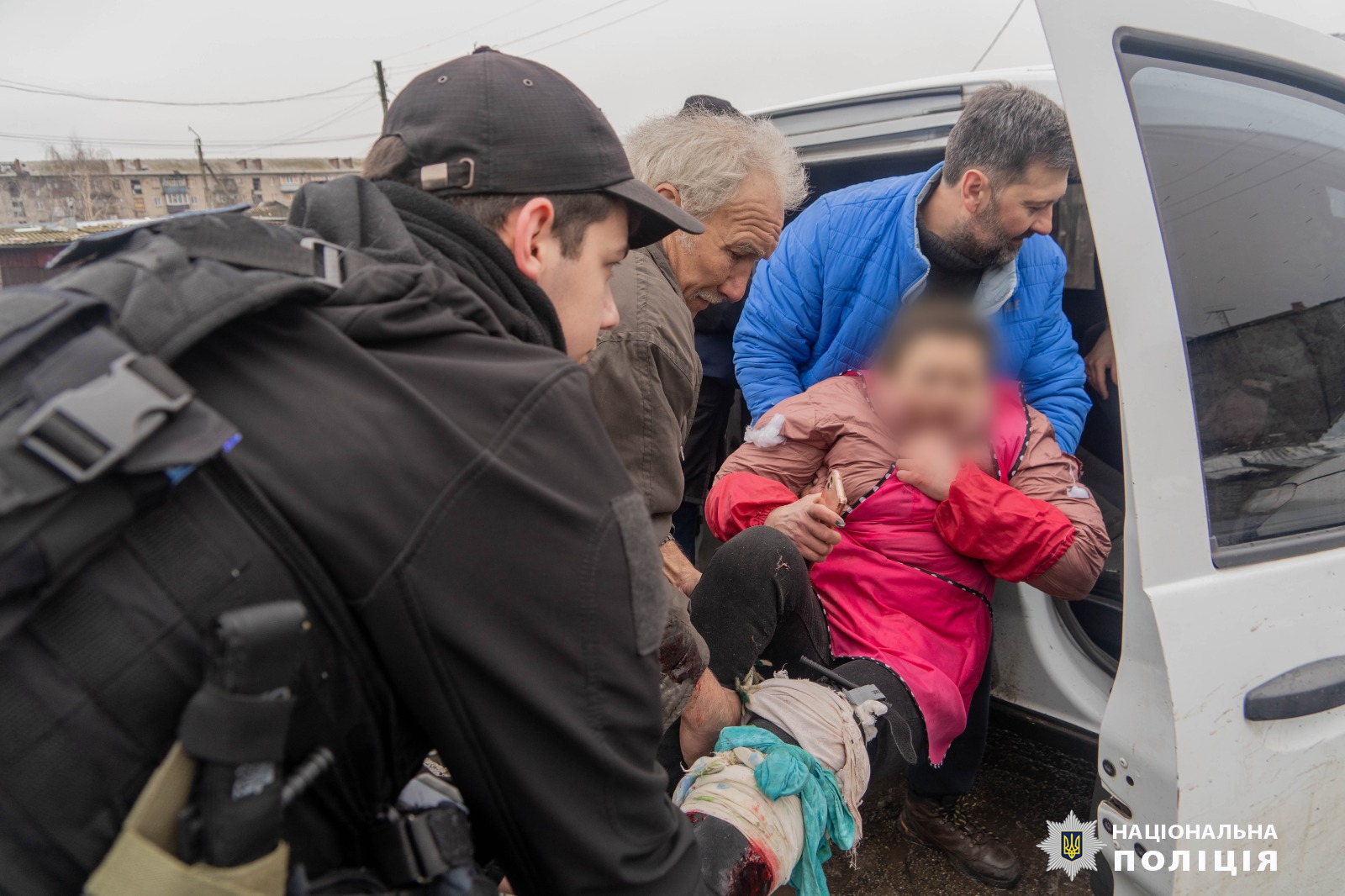 під час російського обстрілу міста вовчанськ одна жінка загинула, ще одна отримала поранення