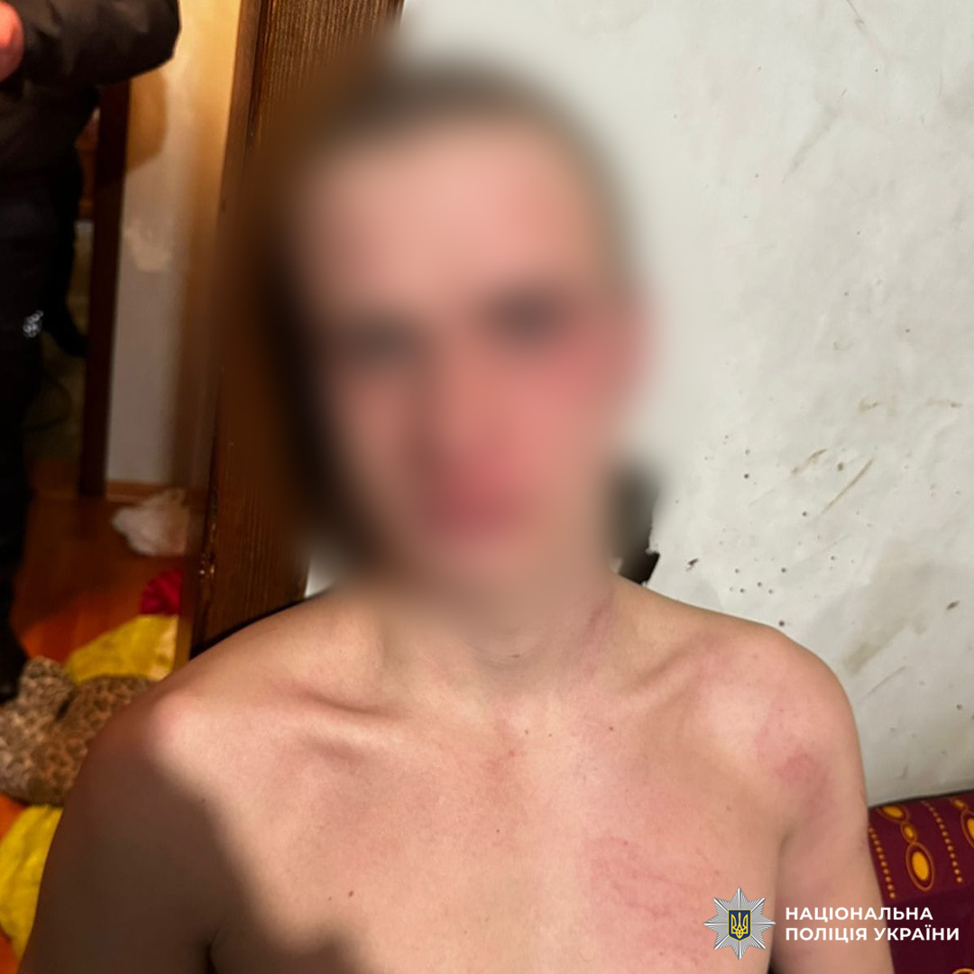 На фото — особа чоловічої статі з коротко підстриженим волоссям, без верхнього одягу, у приміщенні житлового будинку.