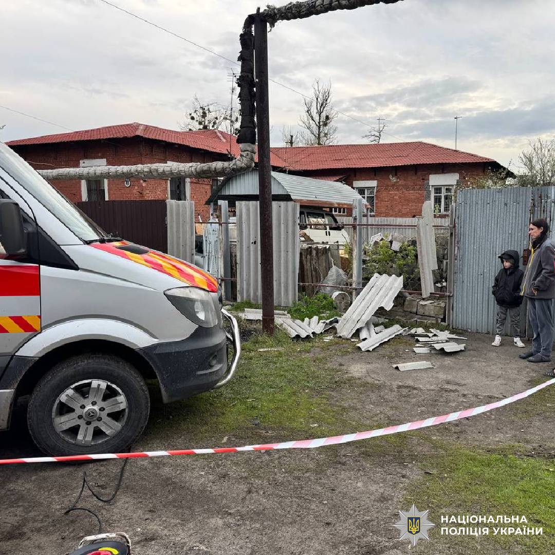 Через обстріл росіян постраждали люди, в тому числі неповнолітня: слідчі відкрили кримінальне провадження за фактом воєнного злочину