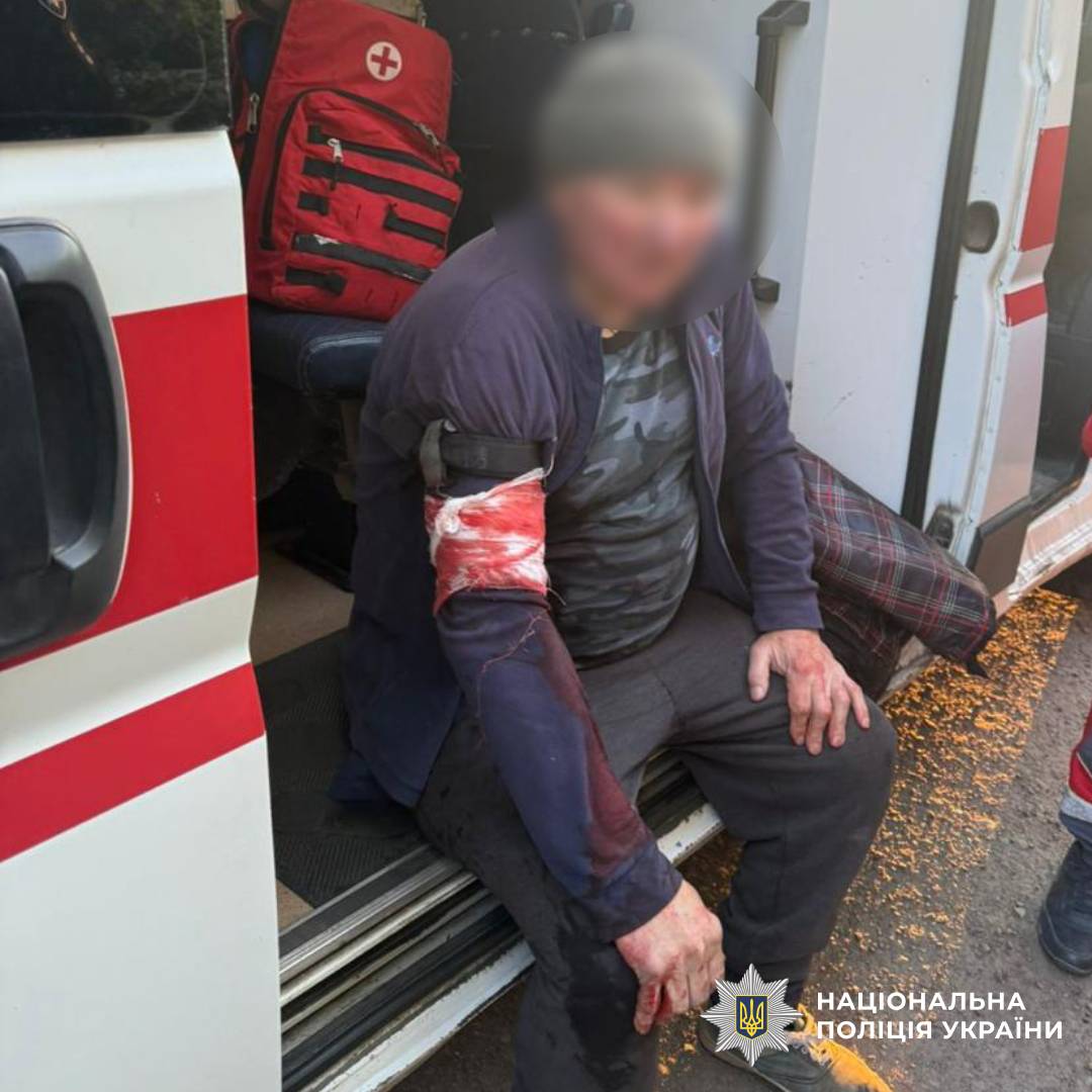 Постраждали громадяни, у тому числі неповнолітній: поліцейські задокументували наслідки ударів окупантів по Харківщині