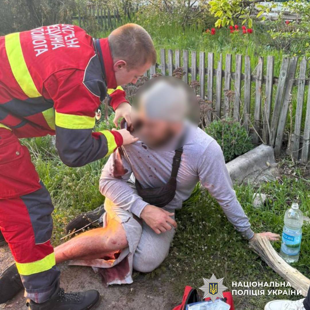 На фото постраждалий внаслідок ворожого обстрілу