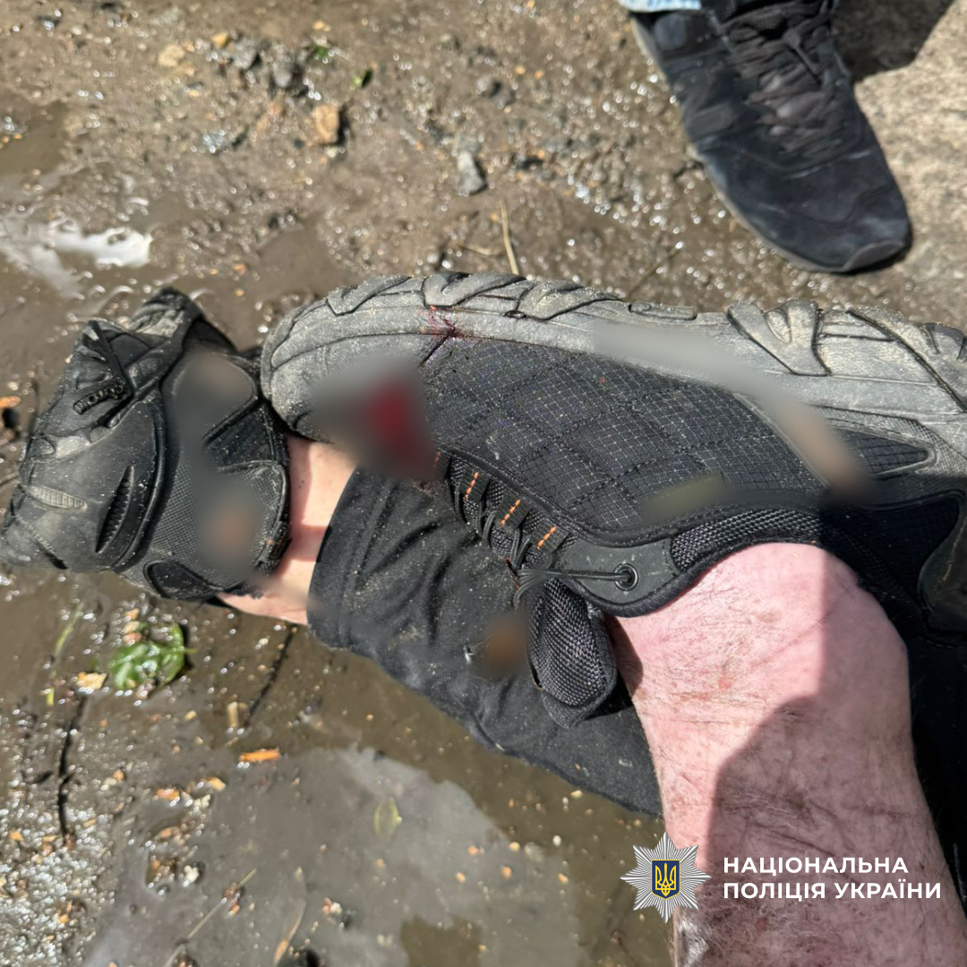 У Чугуєві поліцейські затримали озброєного чоловіка, який чинив опір