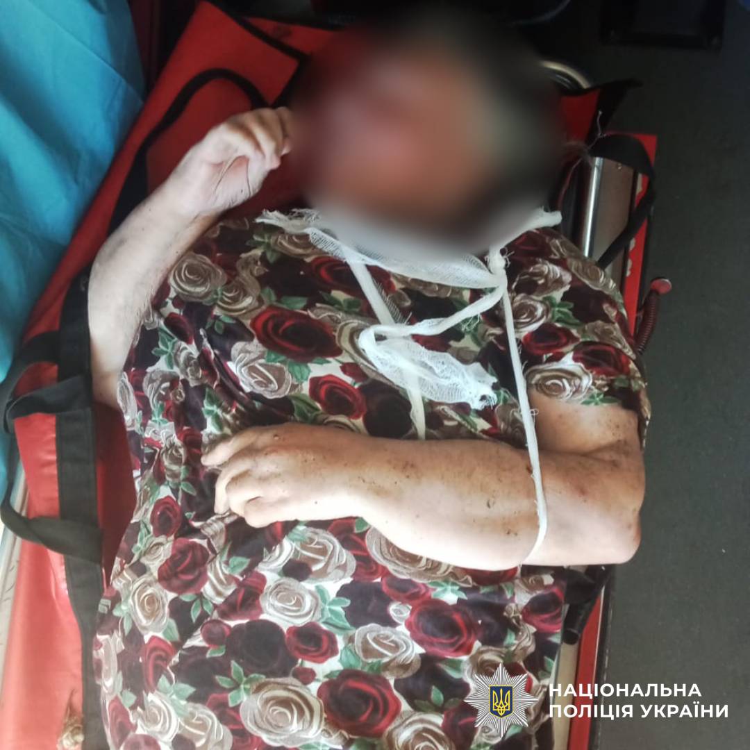 У Харківському районі поліцейський офіцер громади допоміг врятувати літню жінку