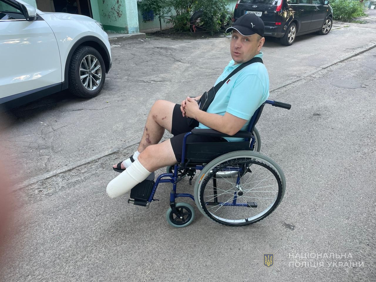 Євген на візку колісному після ампутації кінцівки