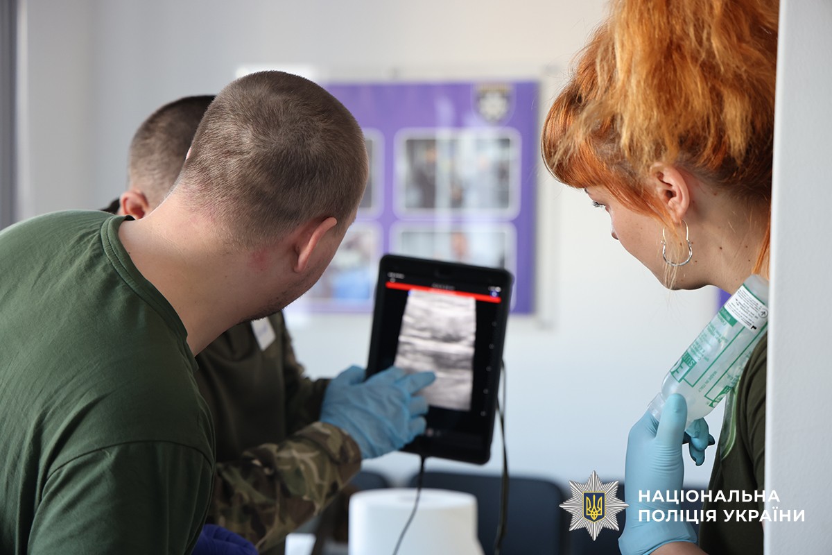 слухачі дивляться на екран УЗД