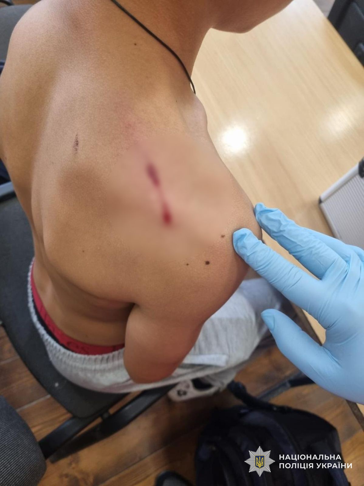 На Закарпатті учень вистрілив у однокласника: поліція працює на місці події (ФОТО)