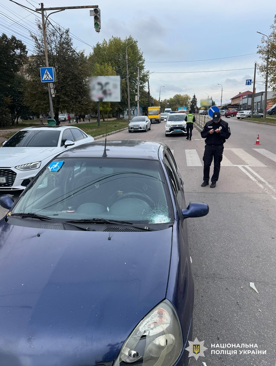 У Бердичеві автомобіль наїхав на жінку, котра переходила дорогу: 55-річна містянка в реанімації